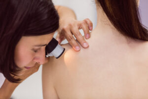 Regular Skin Checkups